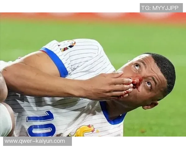 姆巴佩确认继续为法国国家队效力不会回马德里养伤 姆巴佩确认继续为法国国家队效力不会回马德里养伤